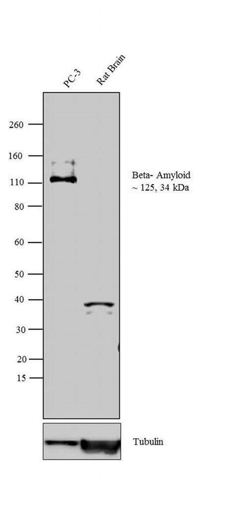 invitrogen beta amyloid